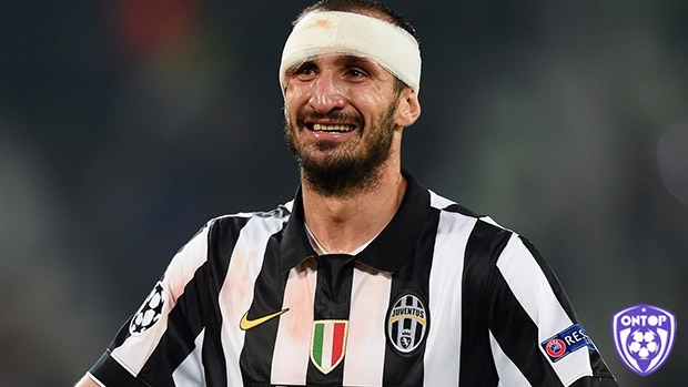 Chiellini là một cầu thủ có phong cách cũng như là lối tấn công độc đáo và đầy ấn tượng